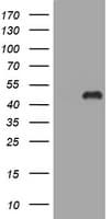 TRIM44 Antibody (clone OTI6B11)