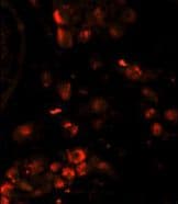Monoclonal Mouse anti-Human LIN28A / LIN28 Antibody (clone 55CT58.12.1, IHC, IF, WB)