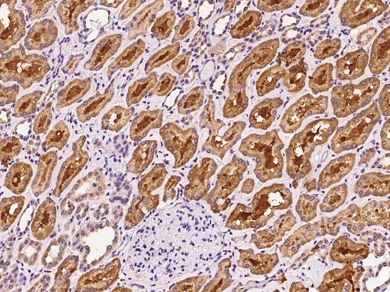 Polyclonal Rabbit anti-Human TRAK1 Antibody (IHC)