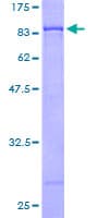 Human GAD1 / GAD67 Protein (Recombinant GST)