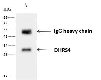 Polyclonal Rabbit anti-Human DHRS4 / PSCD Antibody (IHC, WB)