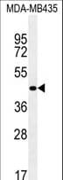 Polyclonal Rabbit anti-Human ZNF625 Antibody (aa60-88, WB)