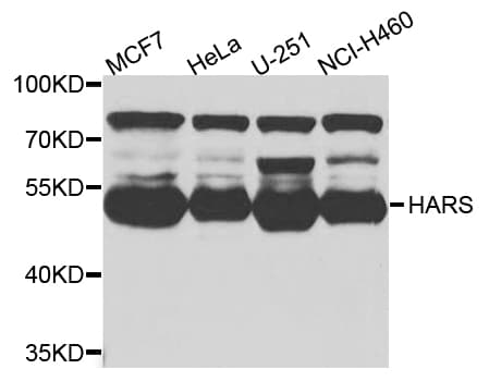 HARS Antibody