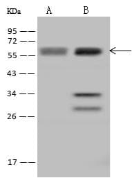 UCKL1 Antibody