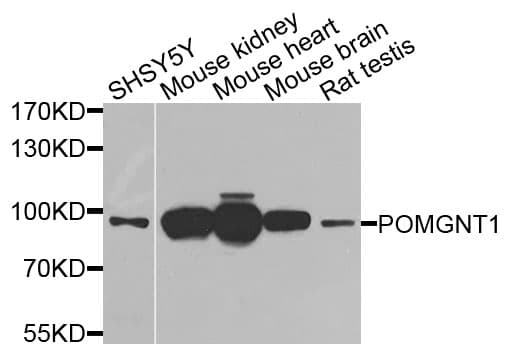 POMGNT1 Antibody