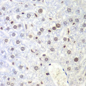 NIRF / UHRF2 Antibody