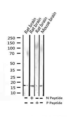 Polyclonal Rabbit anti-Human Histone H3.1 Antibody (phospho-Ser10, IHC, WB)