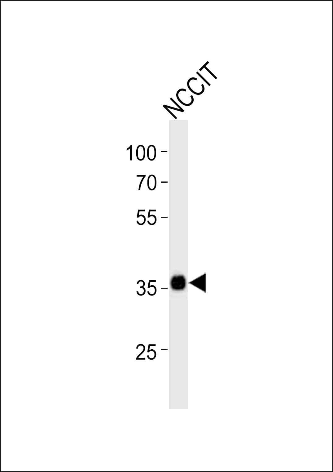 Polyclonal Rabbit anti-Human SOX2 Antibody (aa30-63, WB)