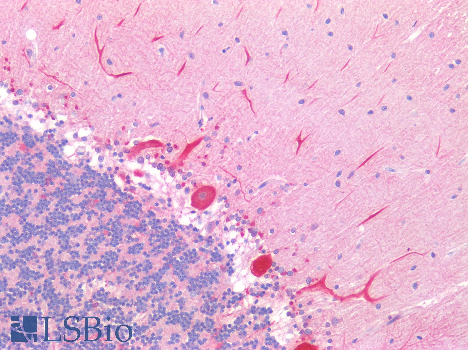 IHC-plus™ Polyclonal Rabbit anti-Human FAP Alpha Antibody (Extracellular Domain, IHC)