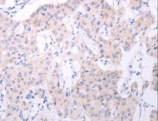 SPATA6 / SRF-1 Antibody
