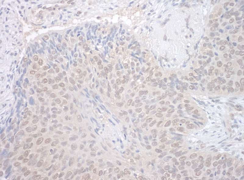 Polyclonal Rabbit anti-Human NEK7 Antibody (aa1-50, IHC)