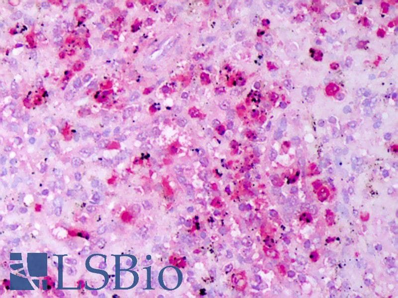 IHC-plus™ DEFA1 / Defensin Alpha 1 Antibody
