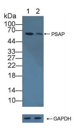 PSAP / Prosaposin Antibody (aa17-524)
