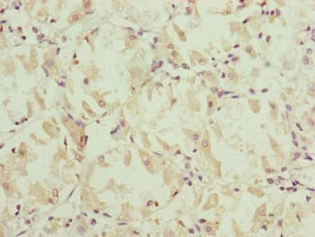 Polyclonal Rabbit anti-Human NDUFS6 Antibody (IHC, WB)