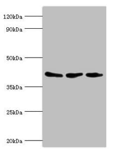 ARFGAP1 Antibody (aa1-220)
