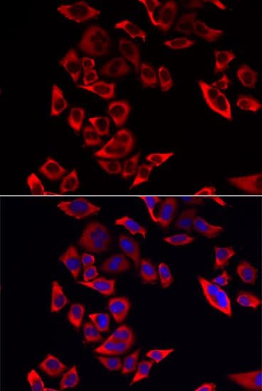 Polyclonal Rabbit anti-Human RPL9 / Ribosomal Protein L9 Antibody (IHC, IF, WB)
