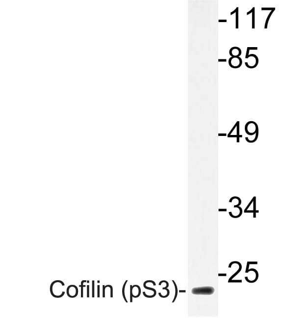 CFL1 / Cofilin Antibody (phospho-Ser3)