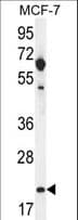 CLDN25 / Caludin 25 Antibody (aa99-128)