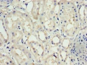 NPHS1 / Nephrin Antibody (aa23-257)