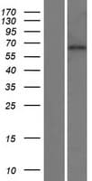 KBTBD11 Protein (Over-Expression Lysate Myc-DDK (Flag))