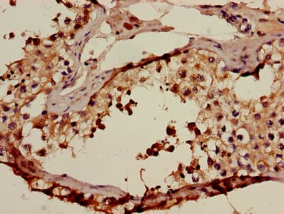 Polyclonal Rabbit anti-Human ACRV1/Intra-Acrosomal Protein Antibody (IHC)