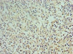 Polyclonal Rabbit anti-Human CD68 Antibody (aa22-319, IHC)