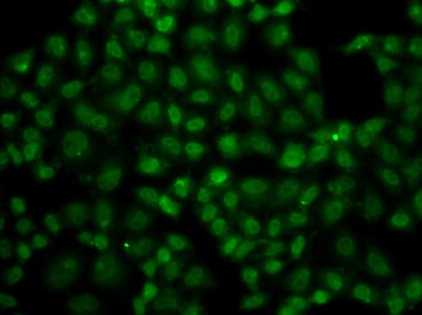 Polyclonal Rabbit anti-Human USP26 Antibody (IHC, IF, WB)