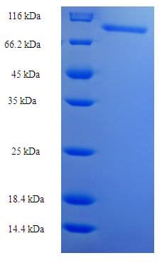 E. coli nrdA Protein (Recombinant His-SUMO)