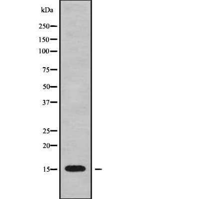 GOLT1B Antibody