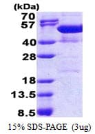 Human NAP1L4 Protein (Recombinant His)