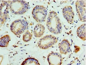 PELI1 / Pellino 1 Antibody (aa1-250)