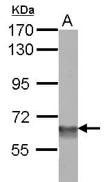 BAF60C / SMARCD3 Antibody