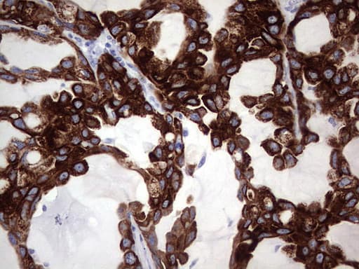 Monoclonal Mouse anti-Human KRT19 / CK19 / Cytokeratin 19 Antibody (clone OTI5H6, aa240-390, IHC, WB)