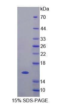 Human TCEB1 / Elongin C Protein (Recombinant)