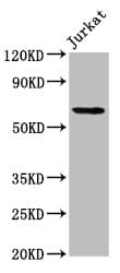 Polyclonal Rabbit anti-Human SLAIN1 Antibody (IHC, WB)