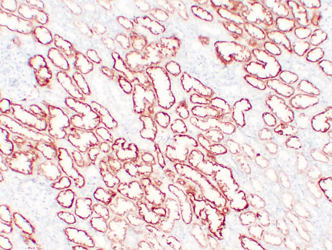 VHL / Von Hippel Lindau Antibody (clone ABT-PVHL)
