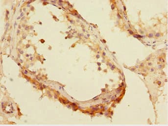 CBFA2T2 / MTGR1 Antibody