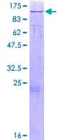 Human MAN2B1 / LAMAN Protein (Recombinant GST)
