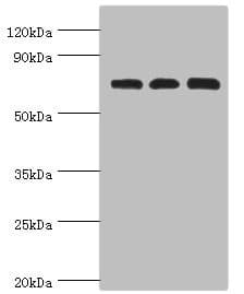 SLC25A13 / CITRIN Antibody (aa1-300)