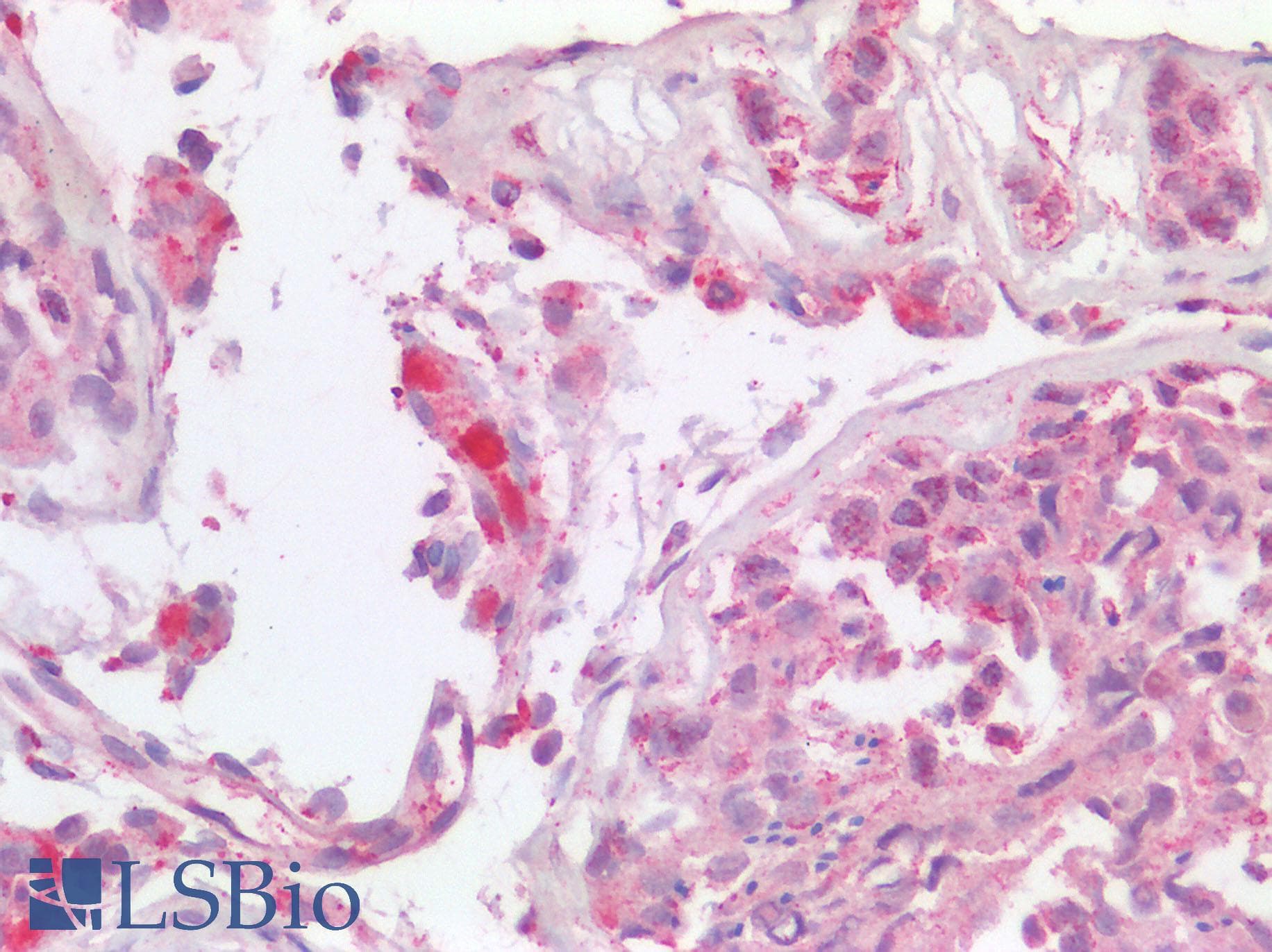CSF2RA / CD116 Antibody (clone 2G5)