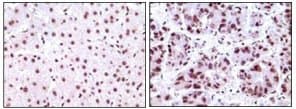 Monoclonal Mouse anti-Human NPM1 / NPM / Nucleophosmin Antibody (clone 7H10B9, IHC, IF, WB)