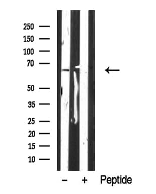 Polyclonal Rabbit anti-Human CRMP1 Antibody (WB)