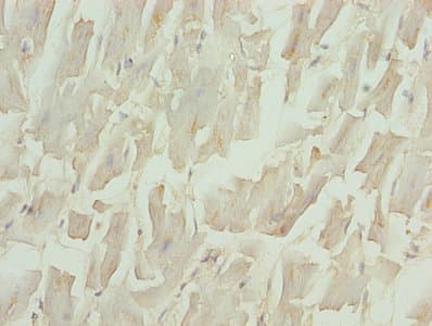 NPPB / BNP Antibody (aa27-101)