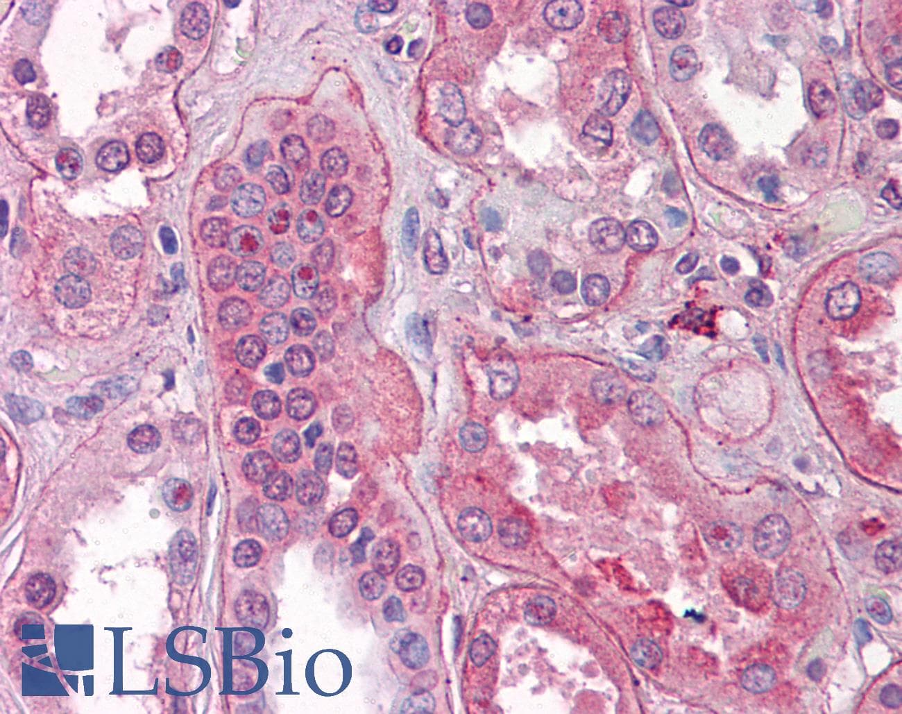 IHC-plus™ FGFR1 / FGF Receptor 1 Antibody (N-Terminus, clone M 17A3)