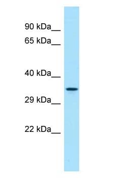 Polyclonal Rabbit anti-Human DUSP13 Antibody (aa69-118, WB)