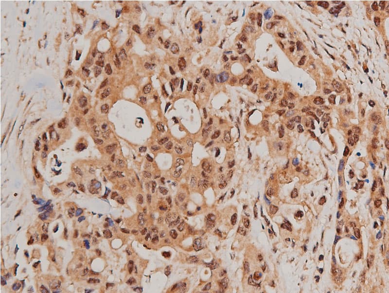 FOXO1 / FKHR Antibody (phospho-Ser319)