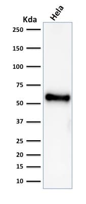 PathPlus™ TP53 / p53 Antibody (clone rBP53-12)