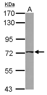 ABCD4 Antibody