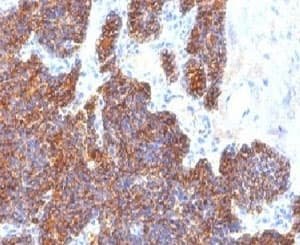 PTH / Parathyroid Hormone Antibody (C-Terminus, clone PTH/1173)