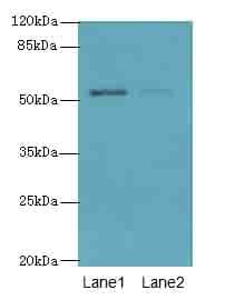 Polyclonal Rabbit anti-Human SLC46A3 Antibody (IHC, WB)
